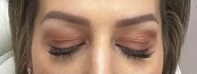 Brows before and after a non-surgical brow lift