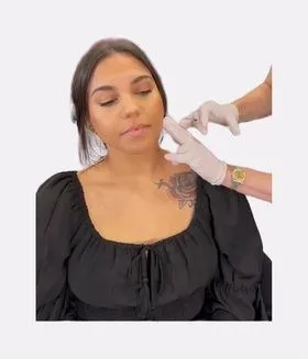 Masseter neurotoxin injection for facial slimming