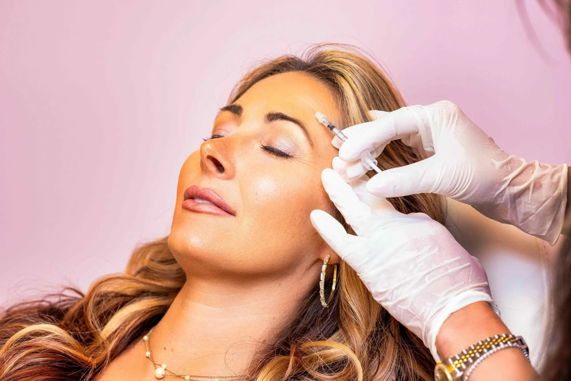 Dermal filler injection