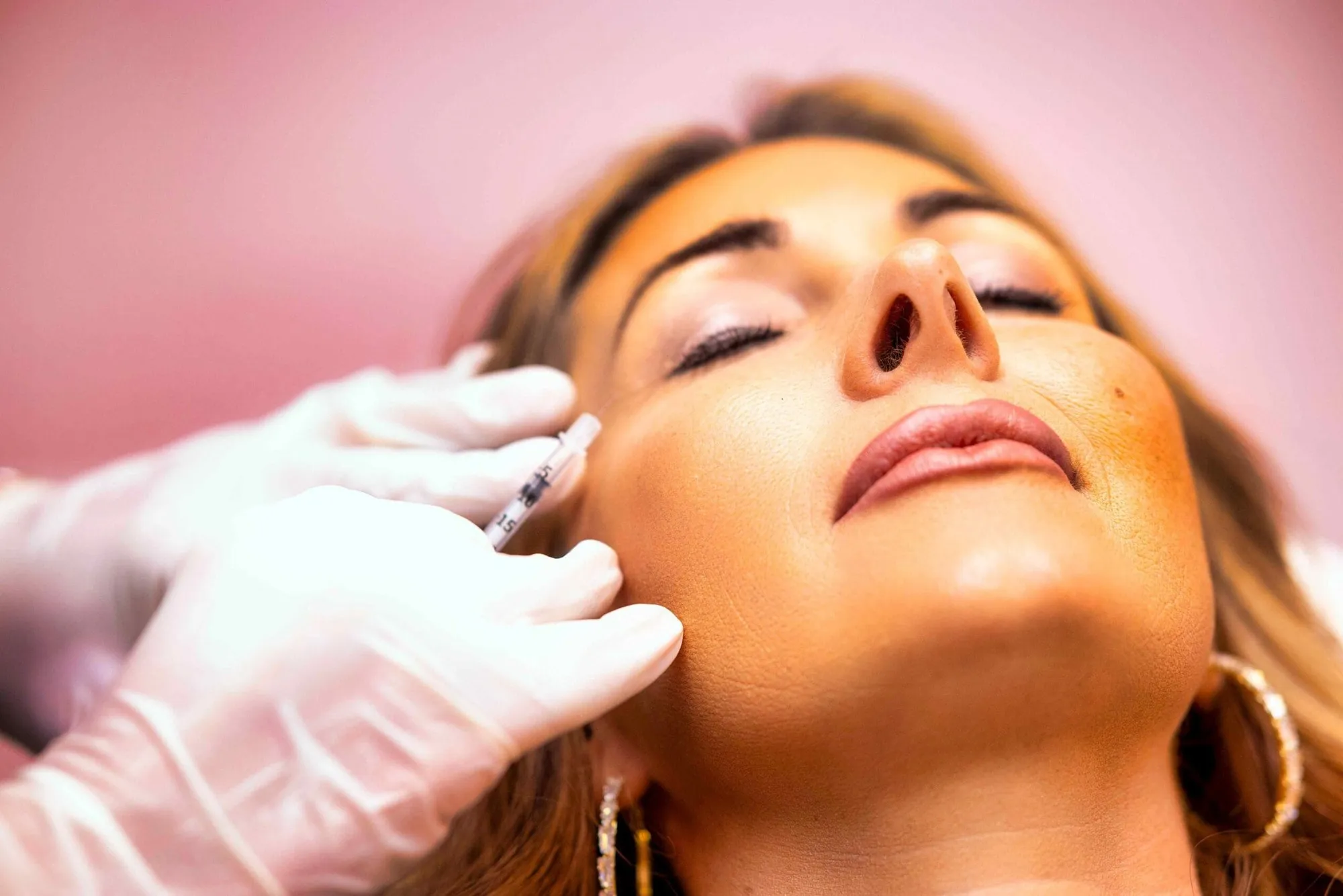 PRP facial treatment