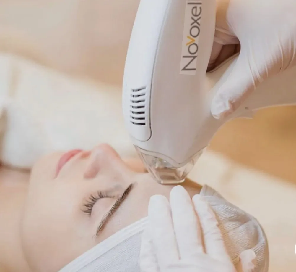 Tixel® treatment